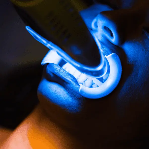 Book your 1 hour laser teeth whitening today! Contact our team now! 