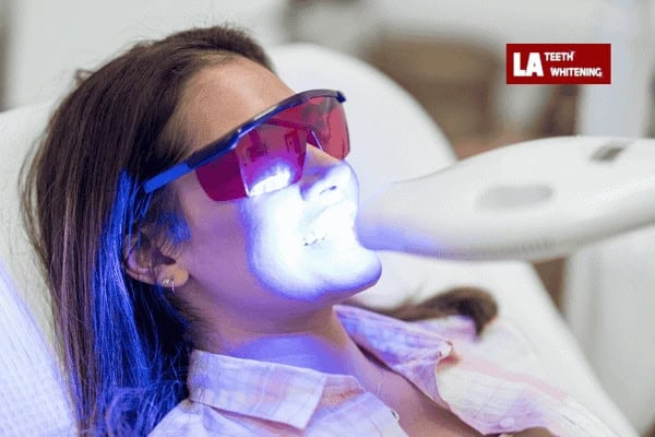 Laser whitening  From LA Teeth Whitening book now! 