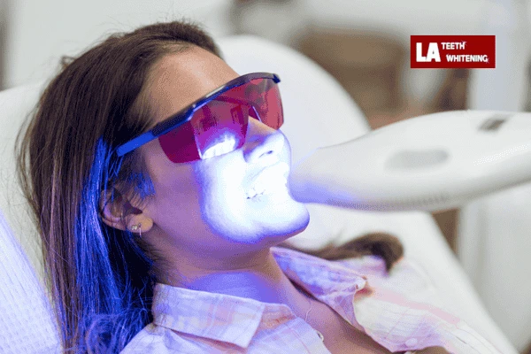 Are you looking for professional whitening  for your teeth? 