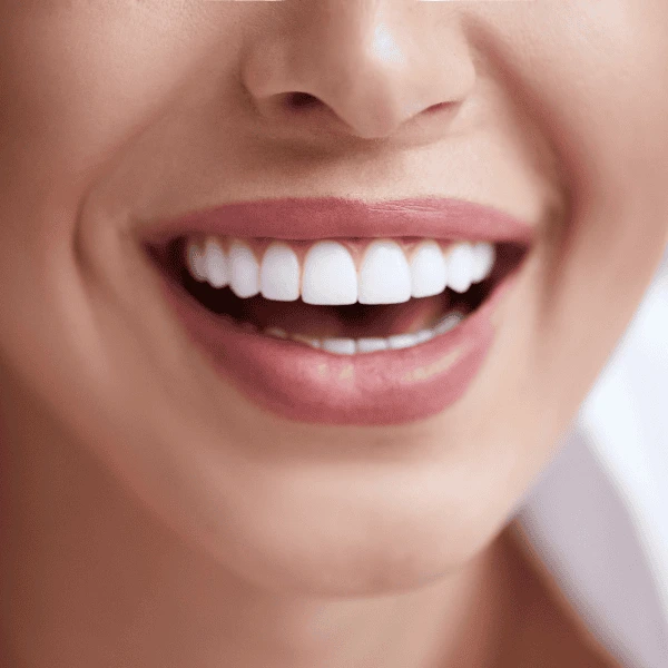 Get A whiter smile fast! Book with LA Teeth Whitening today! 