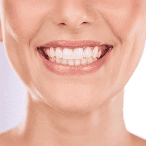 Contact us today to book your Zoom teeth whitening Cambridgeshire. 