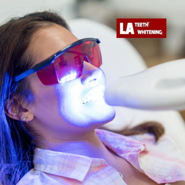 Read our LED Teeth Whitening FAQs Midlands. 